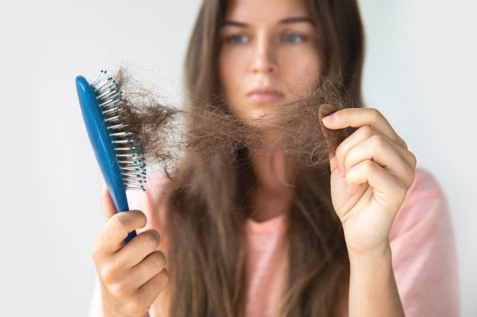 Наследно губење на коса кај жени